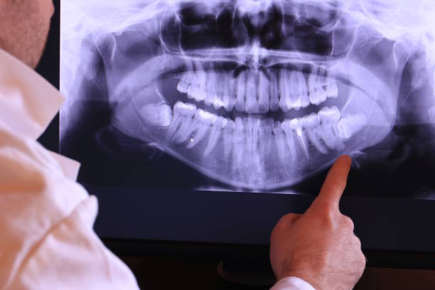 Best Emergency Treatment for Dental Infections or Abscesses in Lyons, WI