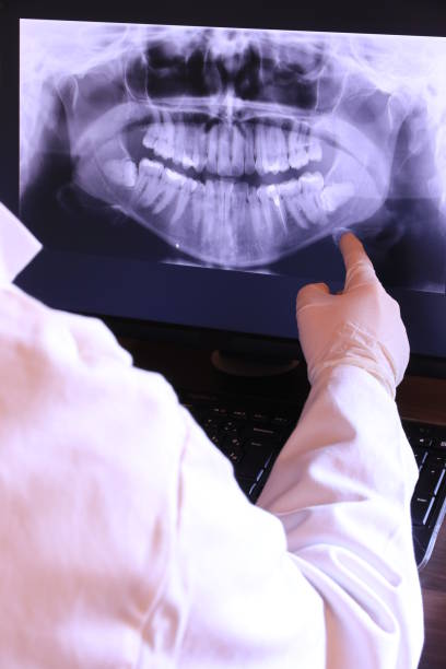 Best Emergency Tooth Extraction in Lyons, WI