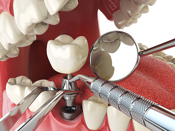 Best Weekend Emergency Dentist in Lyons, WI